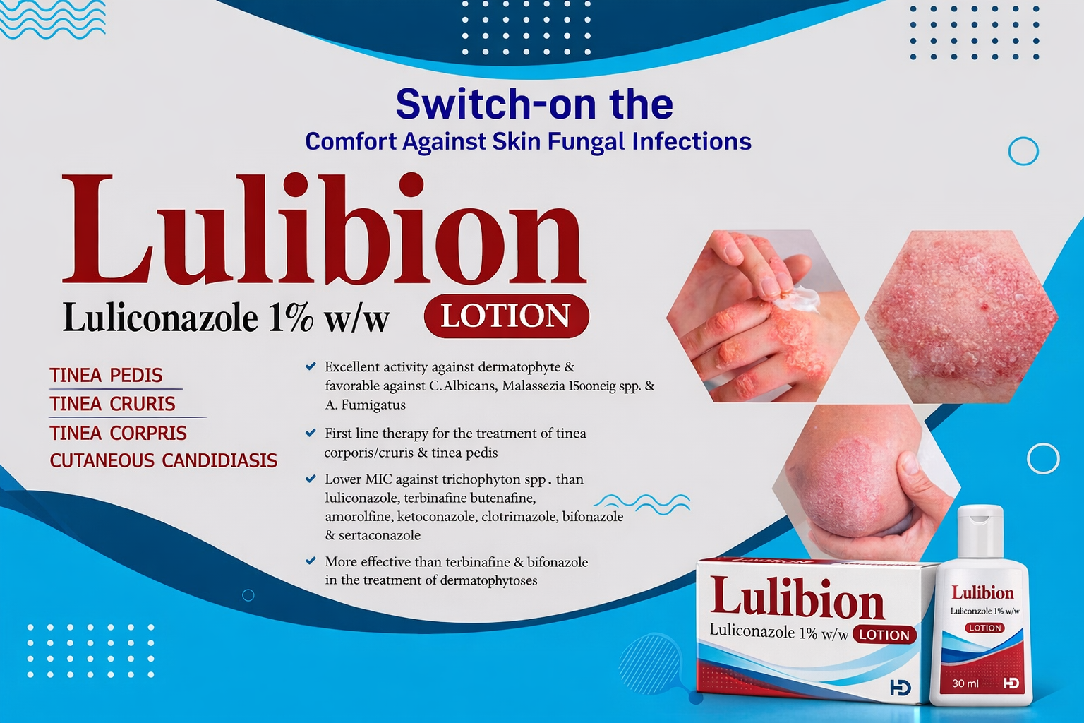 LULIBION Lotion (Luliconazole 1% w/w)