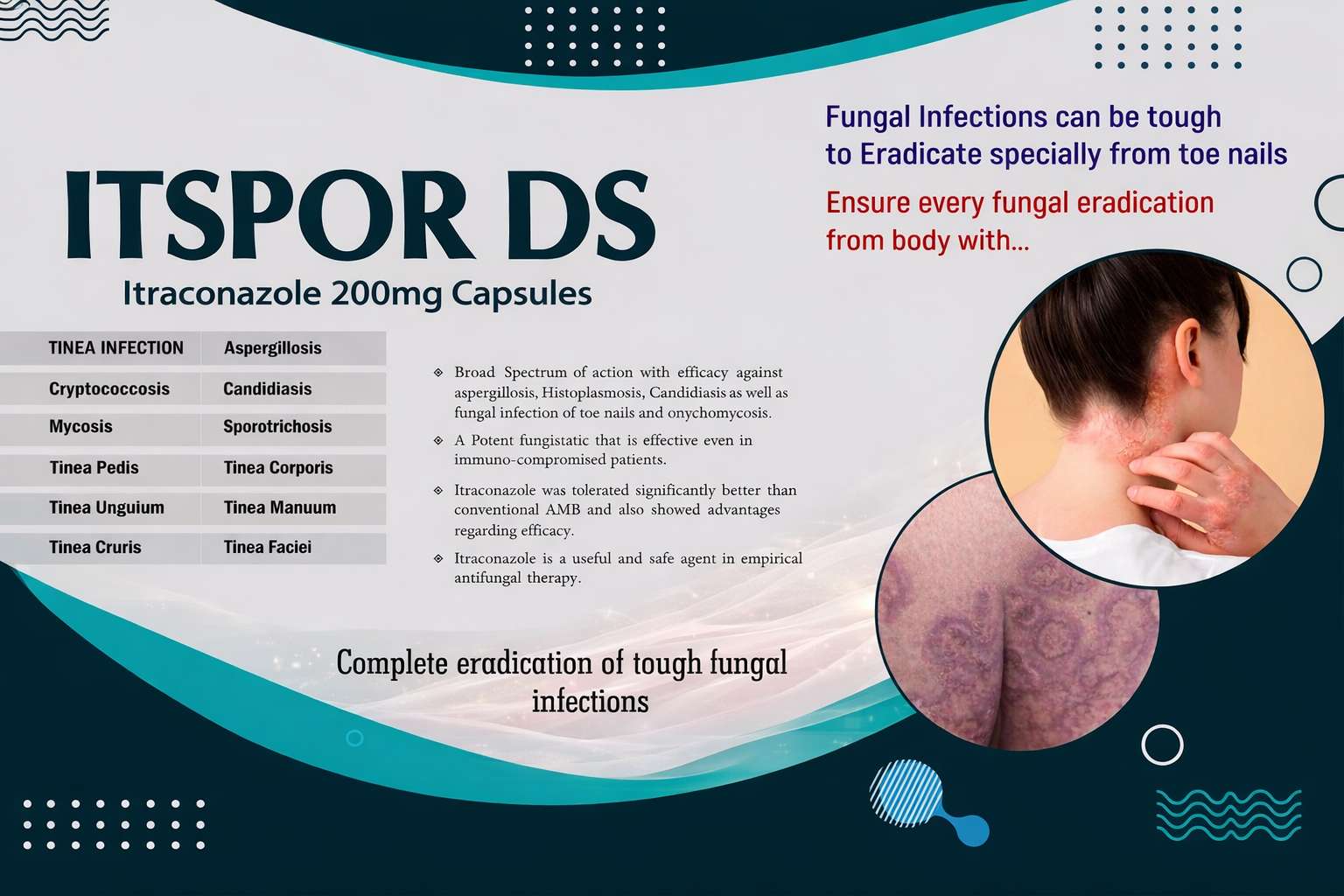 ITSPOR DS